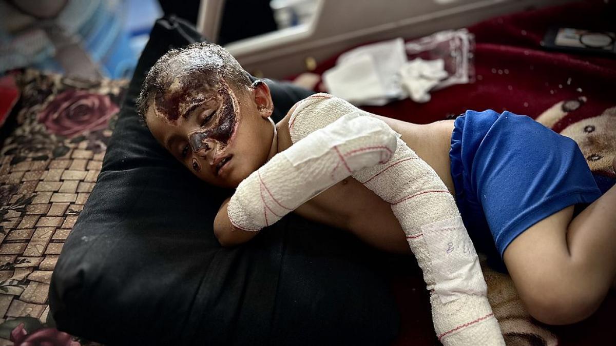 "Unusually serious": the health report that reveals the brutality of the Gazati wounds