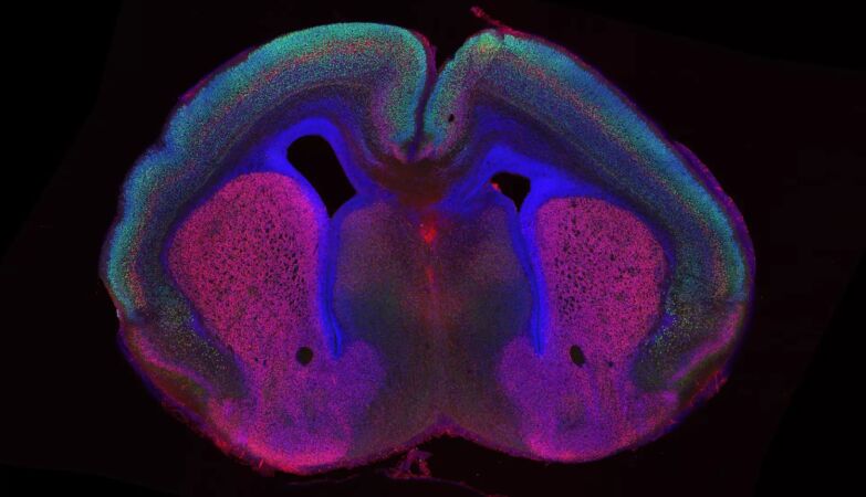 What makes our brain look like a nut?