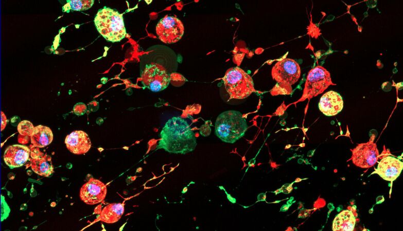 “Footprint of death” gives new clues about the spread of diseases