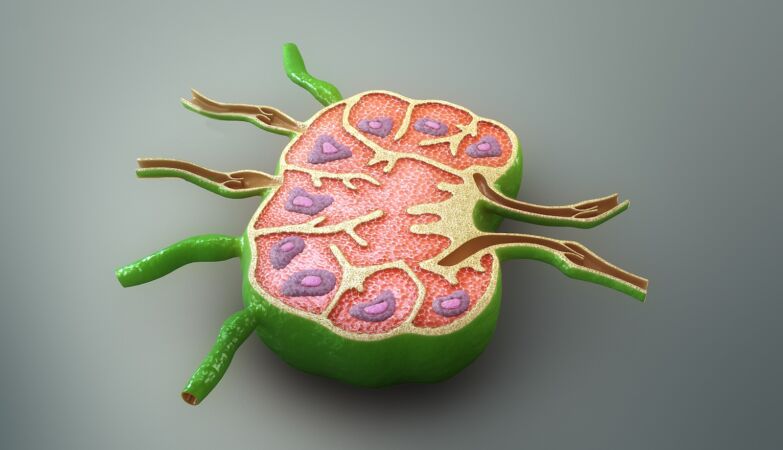 Cutting lymph nodes: New study questions common cancer treatment method