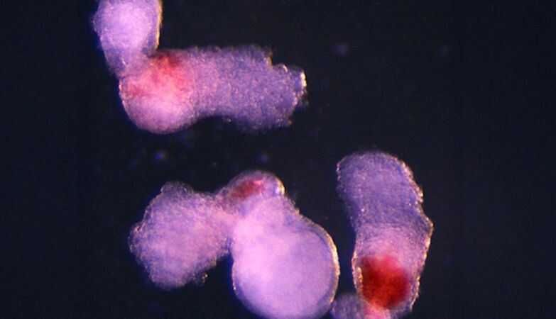 Scientists create “embryo” that produces blood for transplants