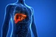 Hepatic steatosis is a silent disease, according to experts