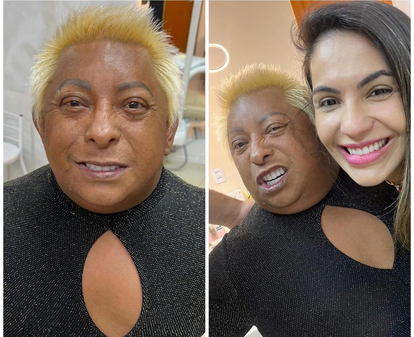 Patixa Teló shows off new smile after putting on dental prosthesis