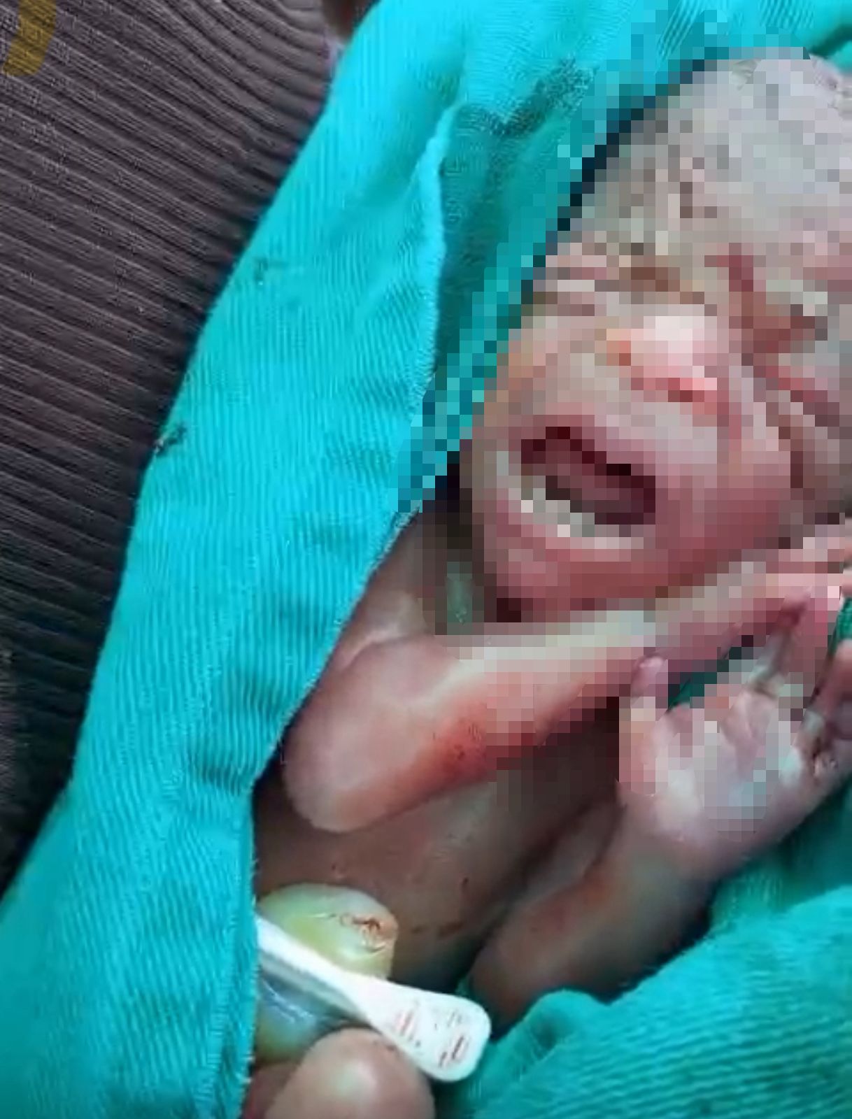 Newborn is almost buried alive in Rio Branco and father says: “They threw him in a bag”
