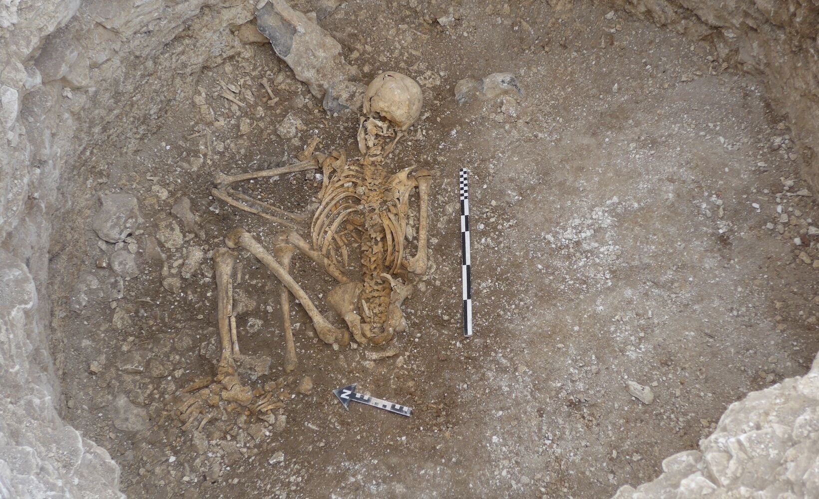 Celtic teenager who died 2,000 years ago was “disposable” and was sacrificed