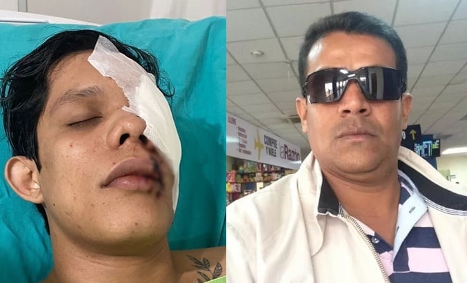 Businessman who attacked and left a teacher blind in Acre dies after a massive heart attack