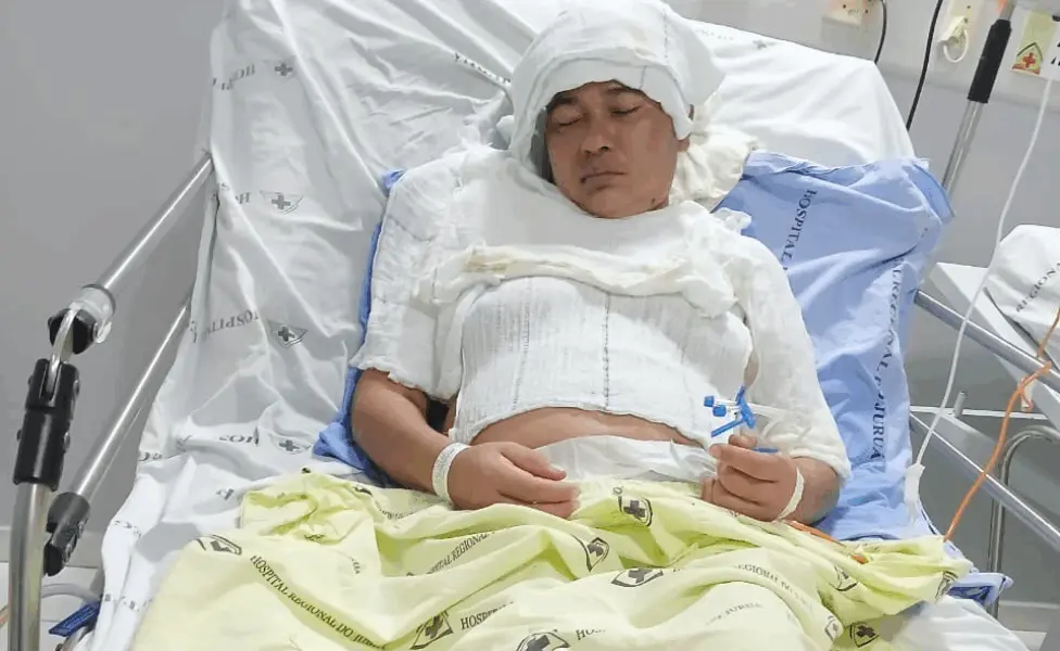 Patient with brain tumor and meningitis dies waiting for INSS benefit in Acre