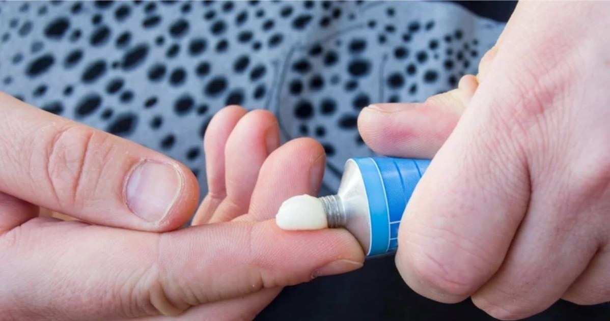 Vitamin A ointment works great on the skin, nourishing it and protecting it against unfavorable conditions /123RF/PICSEL