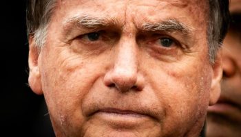 Bolsonaro has been suffering from hiccups and vomiting episodes for 23 hours