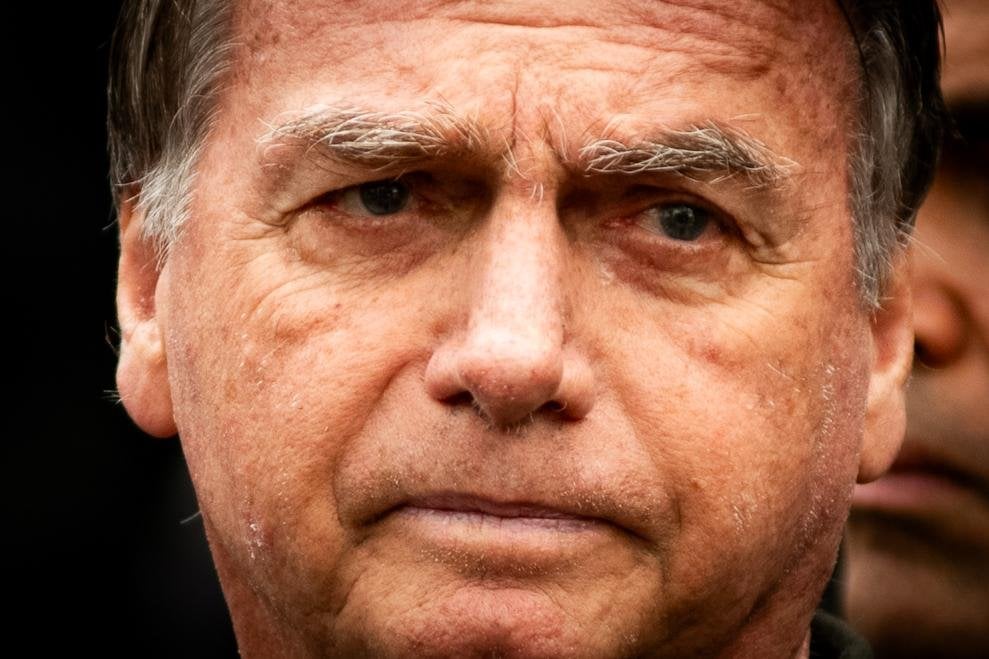 Bolsonaro has been suffering from hiccups and vomiting episodes for 23 hours