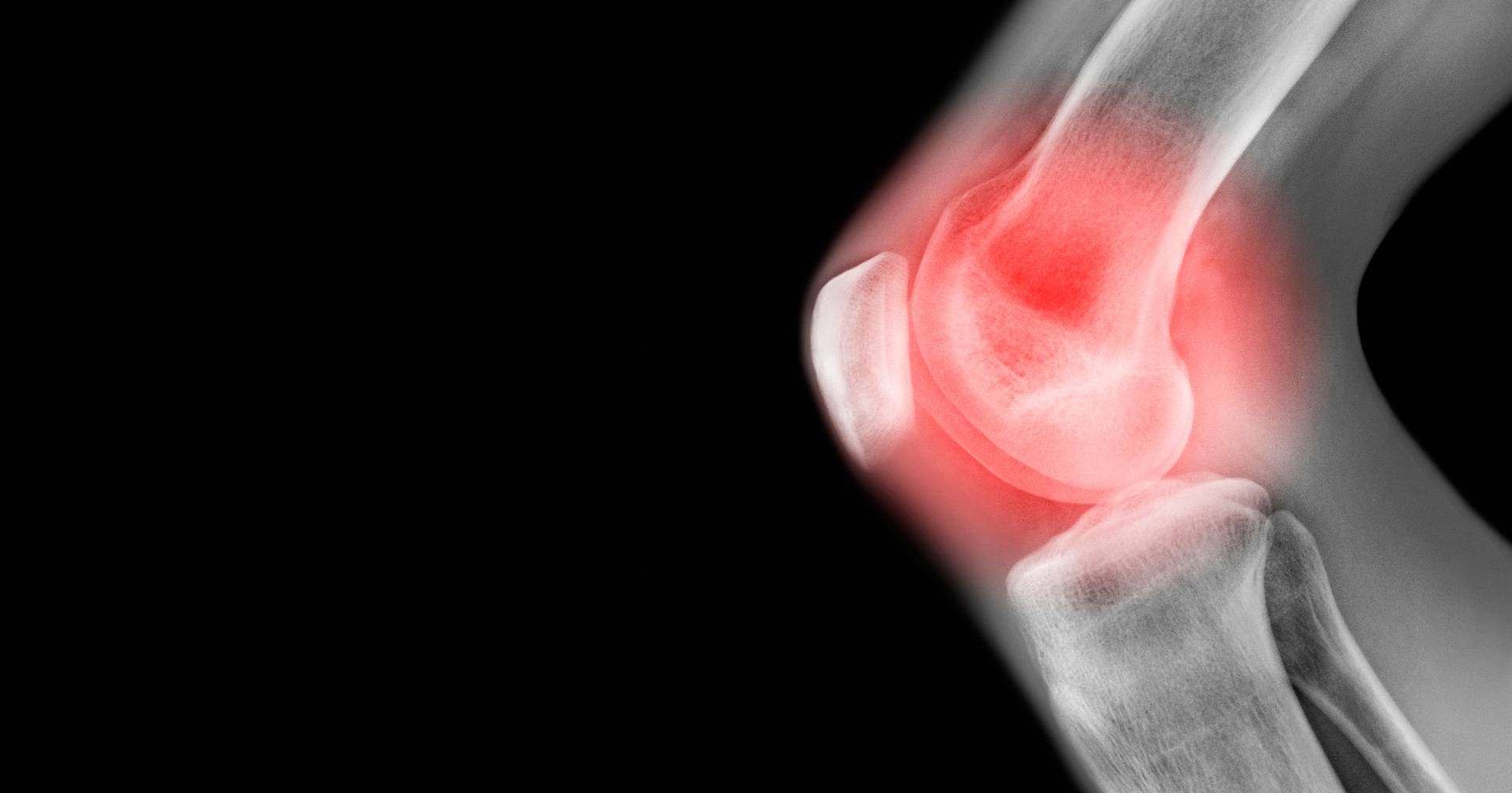 Is gelatin good for your bones?