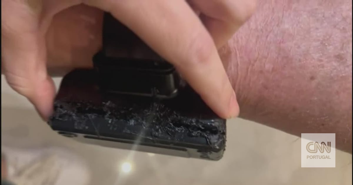 This is how Jair Bolsonaro's electronic bracelet turned out: "I used a hot iron out of curiosity", explains the former president of Brazil