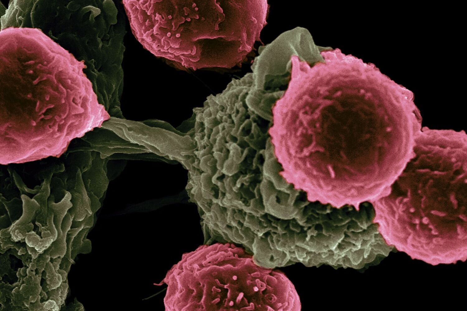 Scientists are creating kamikaze bacteria that treat cancer, self-destruct and disappear
