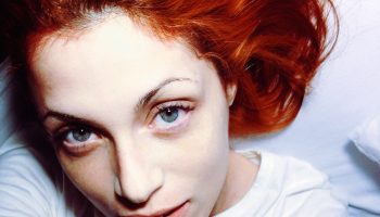 Redheads tend to take longer to heal wounds. Why?