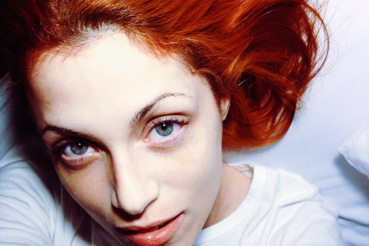 Redheads tend to take longer to heal wounds. Why?