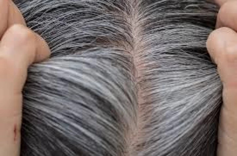 Breakthrough discovery: Graying of hair, a protective mechanism against cancer