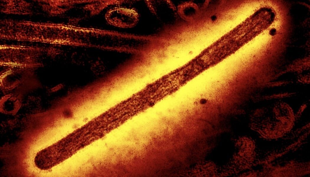 First death in the world caused by the H5N5 strain of bird flu recorded in the USA