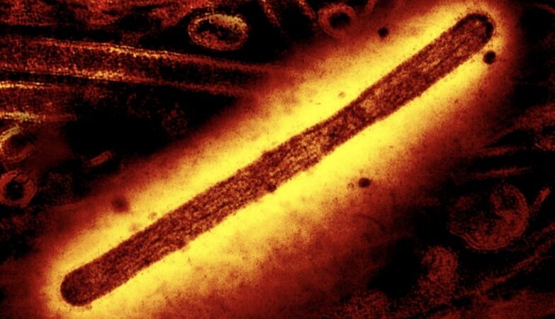 First death in the world caused by the H5N5 strain of bird flu recorded in the USA