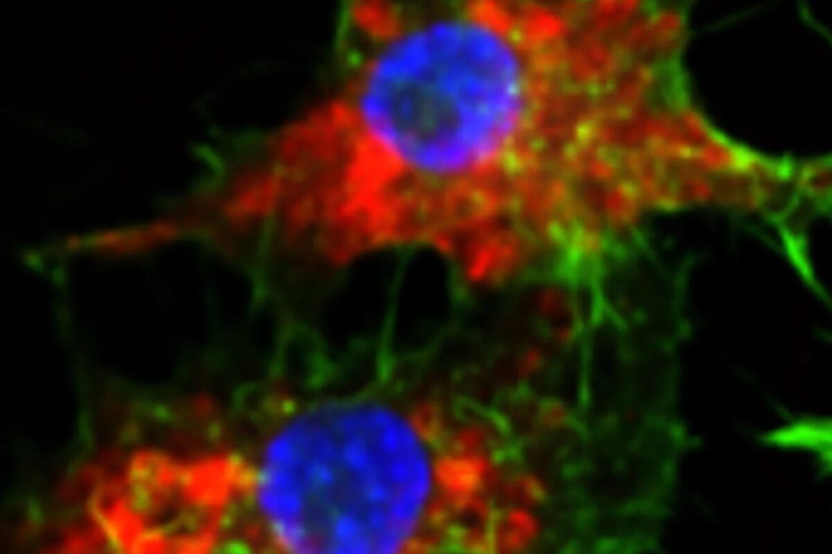 New drug is 20,000 times more effective at killing cancer (without side effects)
