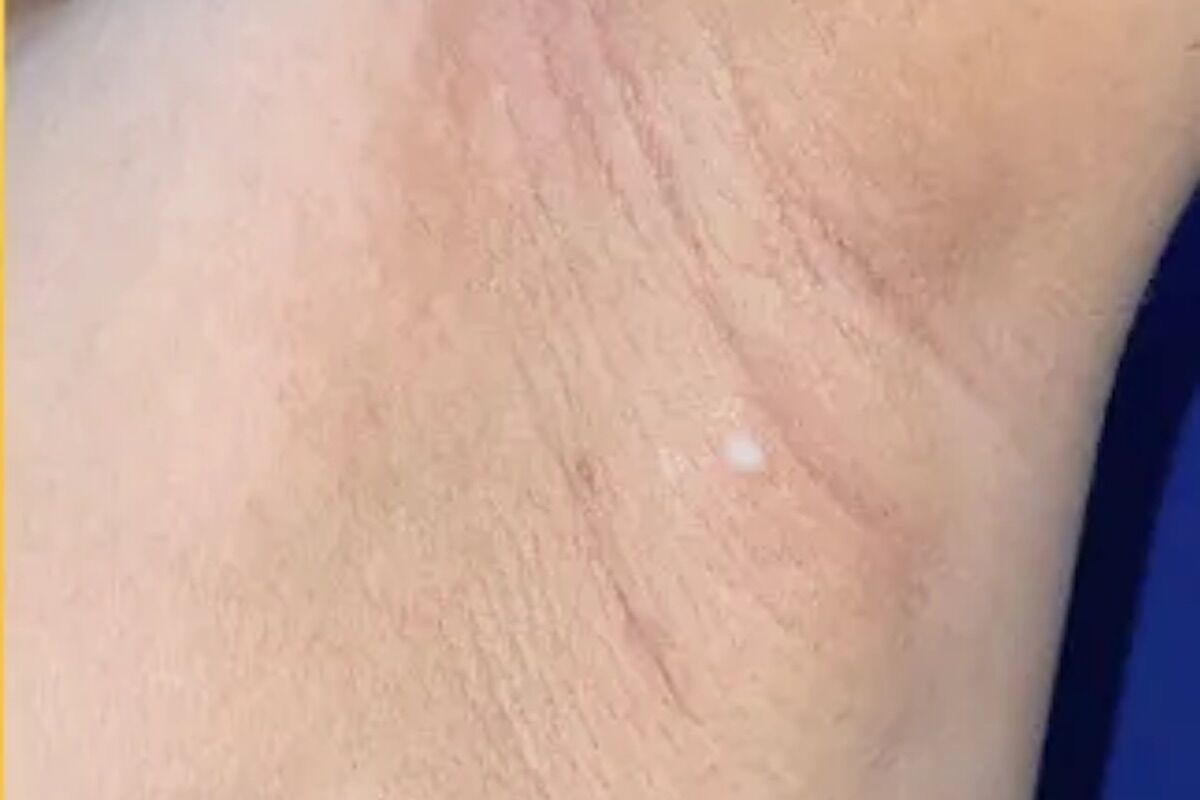 A woman started pouring milk… through her armpits. Had accessory breasts