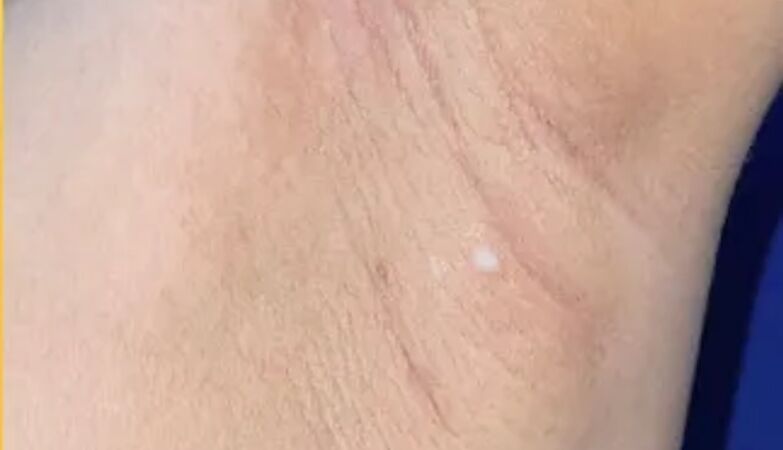 A woman started pouring milk… through her armpits. Had accessory breasts