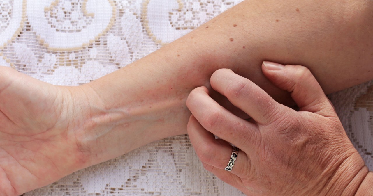 Forget about dry and rough skin in winter. This is how you restore its smoothness