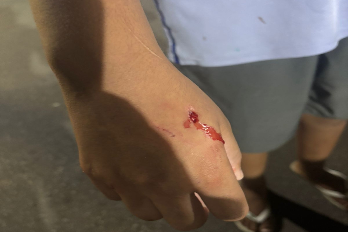 Morador grava PMs atirando e matando pit-bulls que atacaram criança - destaque galeria