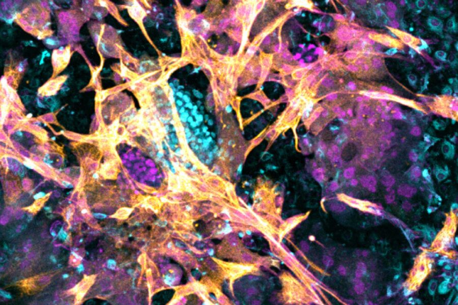 “Tremendous progress.” Scientists successfully implant embryo into artificial endometrium