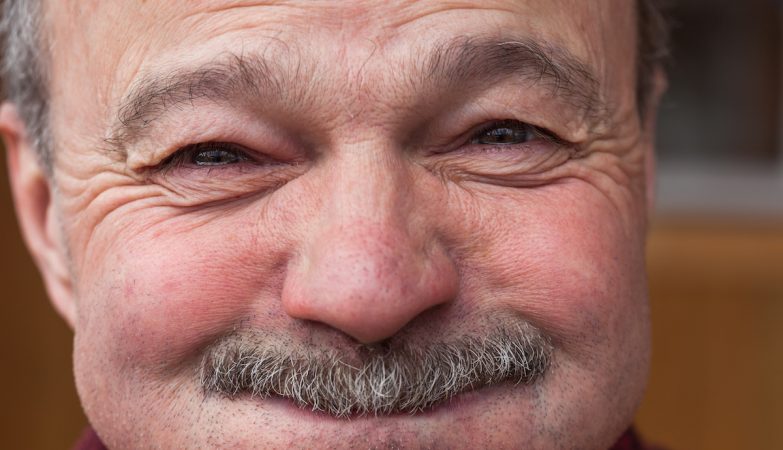 Isn't laughter the best medicine? Alex died after half an hour of laughter