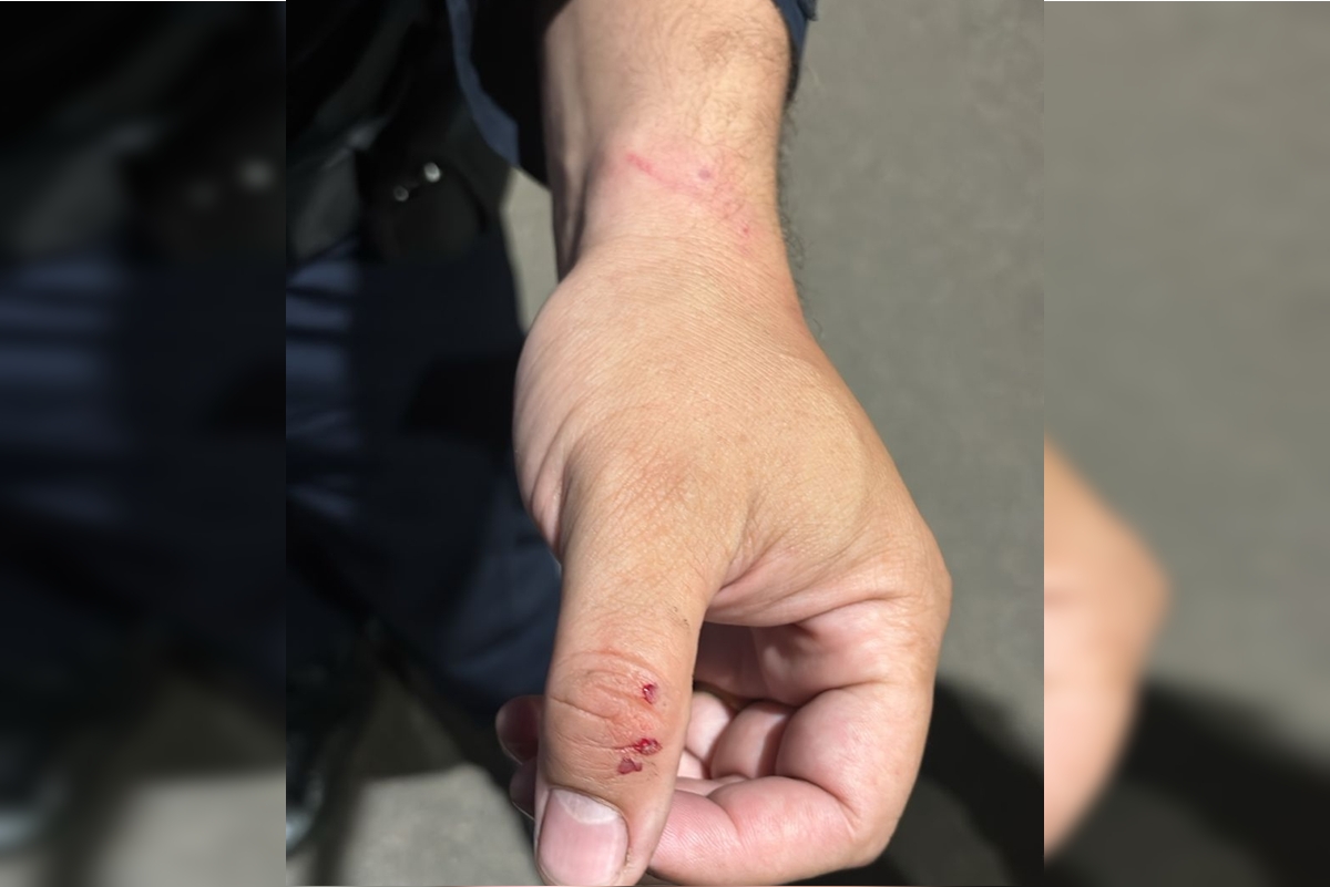 The military police officer was injured in the hand