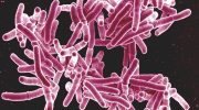 Scientists discover how to eradicate tuberculosis, the world's deadliest infectious disease
