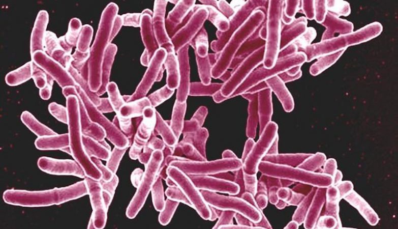 Scientists discover how to eradicate tuberculosis, the world's deadliest infectious disease