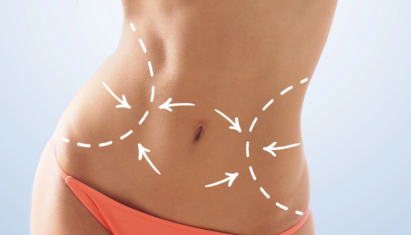 Customizable avatar. There are women spending a fortune to remove ribs