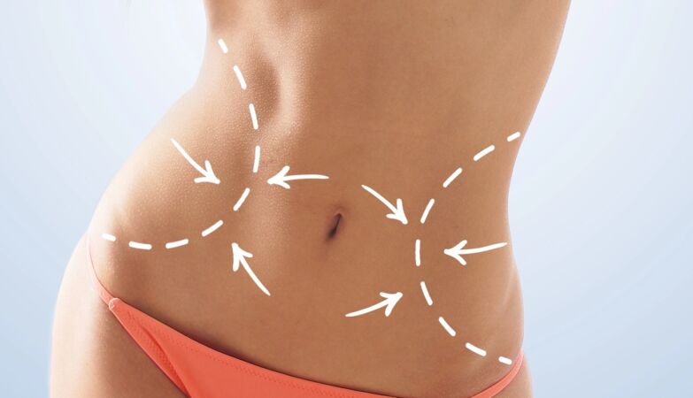 Customizable avatar. There are women spending a fortune to remove ribs