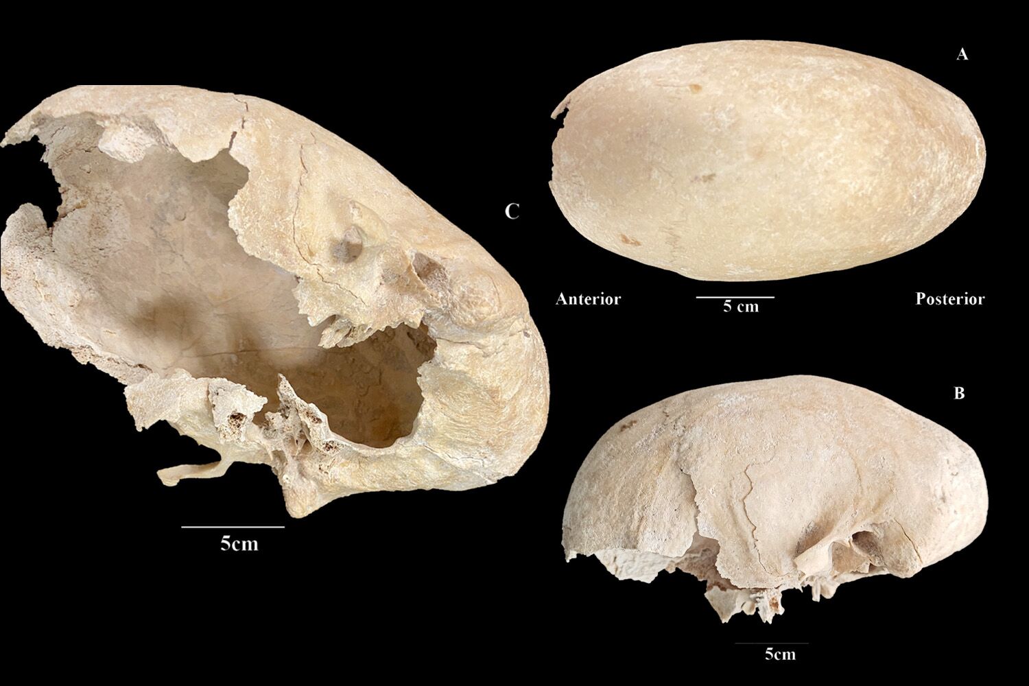 “I’ve never seen anything like this.” Knight of the Order of Calatrava had an elongated skull