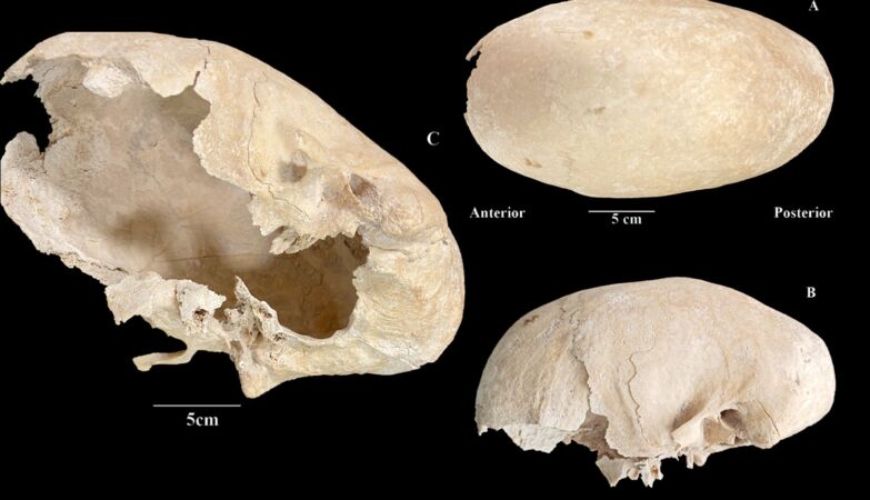 “I’ve never seen anything like this.” Knight of the Order of Calatrava had an elongated skull