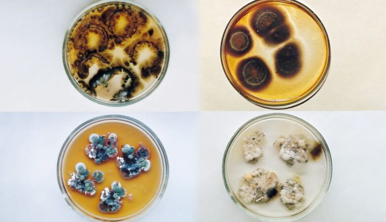 The mystery of the strange black fungus from Chernobyl that survives — and performs “photosynthesis”