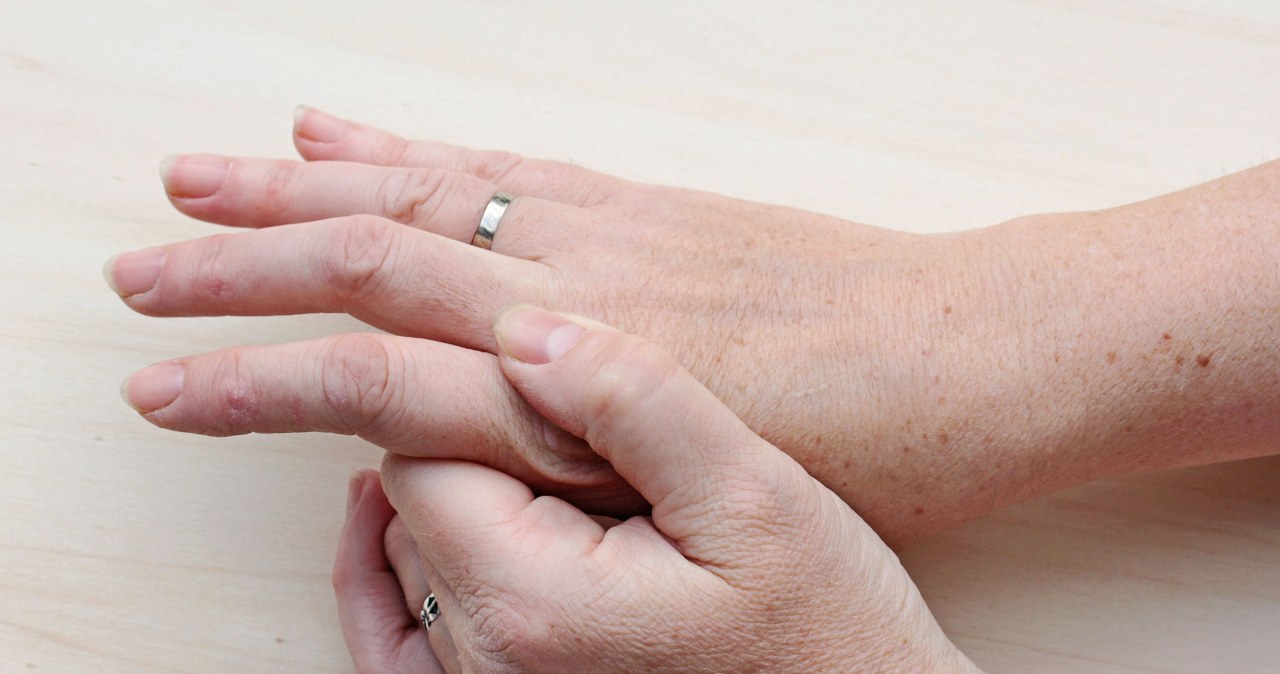 I add it to the soup, mix the rest with lemon and rub it on my hands. Discolorations disappear