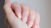 Do your nails look like this? This may be an important signal from the body