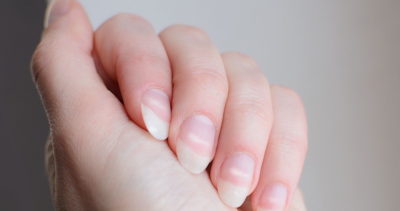 Do your nails look like this? This may be an important signal from the body