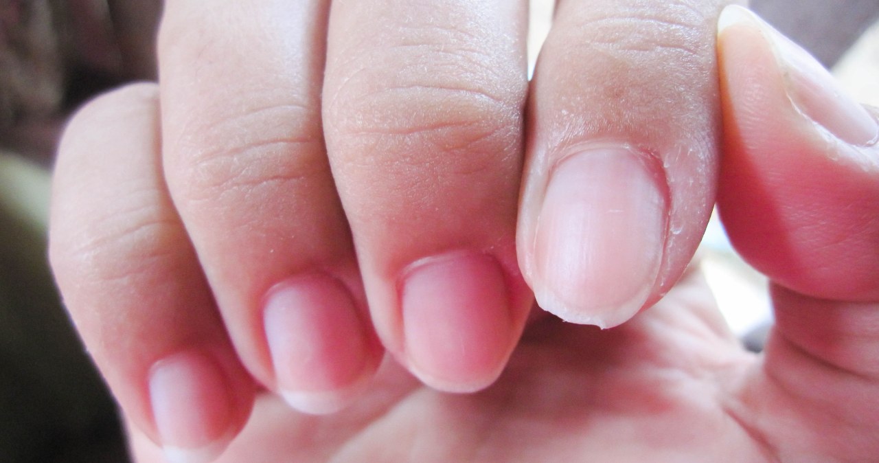 Your nails will stop breaking and will grow faster. Just soak them in it