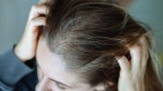 Stress and hair loss: what science says and possible treatments
