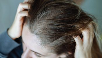 Stress and hair loss: what science says and possible treatments