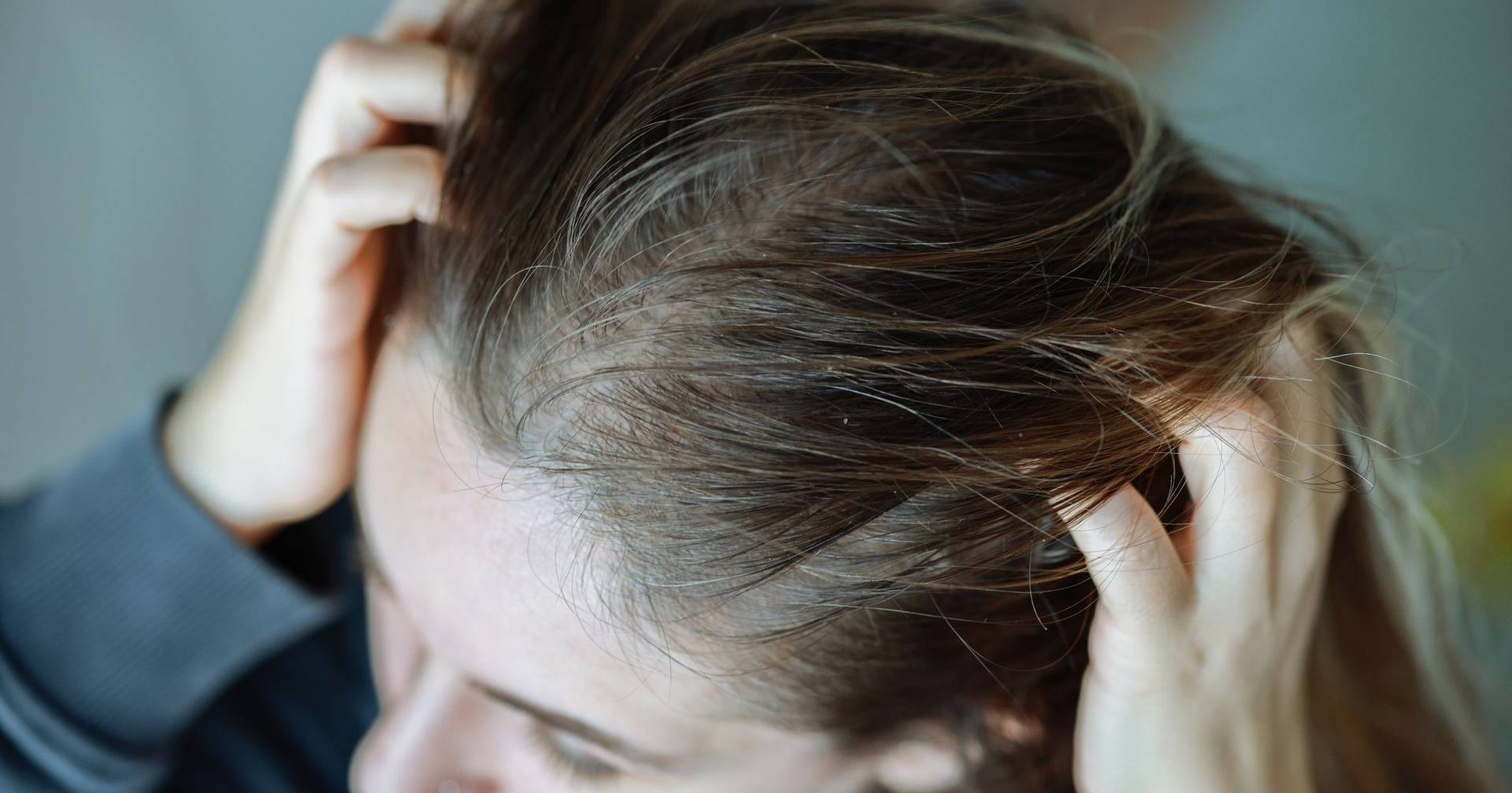 Stress and hair loss: what science says and possible treatments