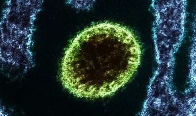 Nipah virus worries in Asia – and inspired film about pandemic caused by bats