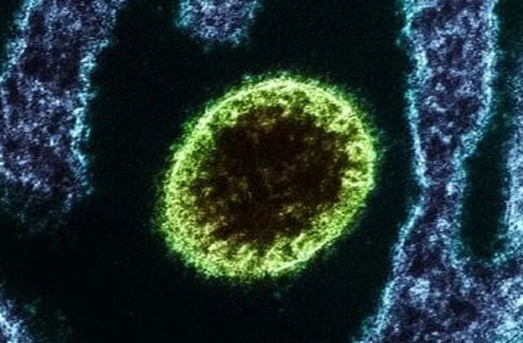 Nipah virus worries in Asia – and inspired film about pandemic caused by bats