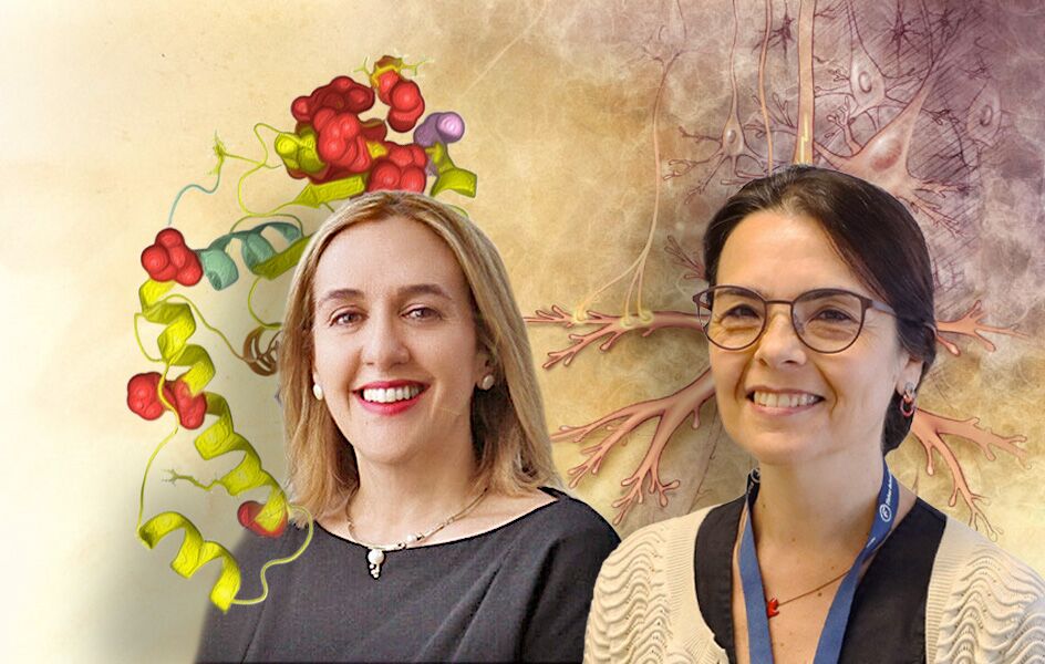 Compound discovered that may delay symptoms of Machado-Joseph disease