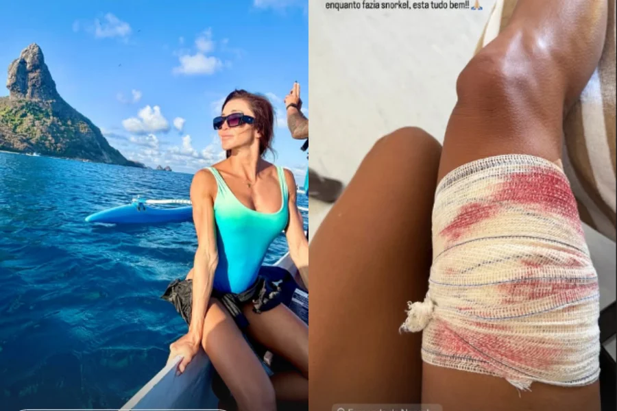 Shark attacks surfer while diving and guide intervenes to prevent serious injuries