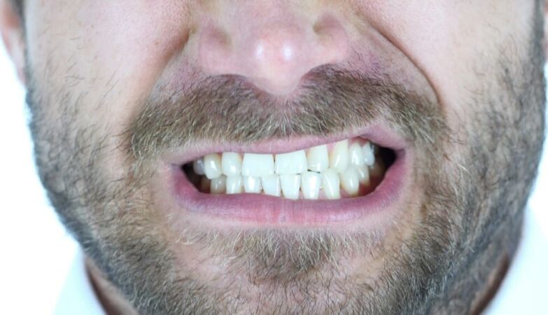 3 hidden signs that you are grinding your teeth (and what you should do)