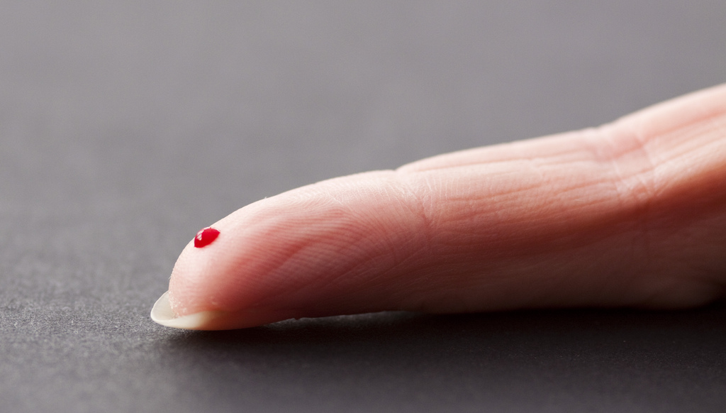 Drop of blood from fingertip can detect Alzheimer's
